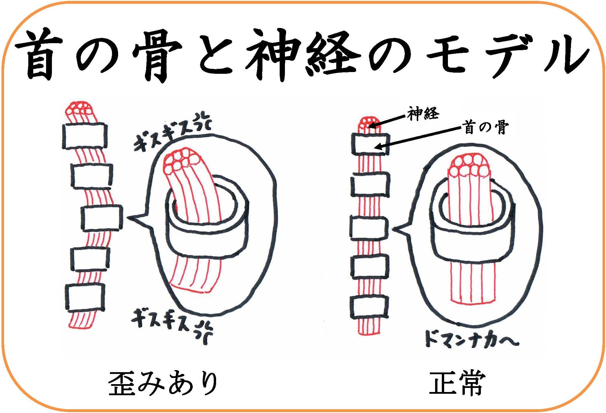 神経圧迫.jpg