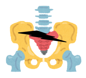 関節の誤動作が原因の腰痛